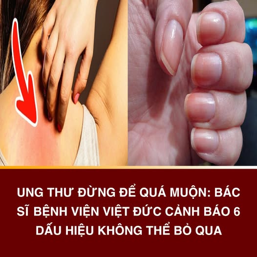 Ung thư ƌừng ƌể quá muộn: Bác sĩ Bệnh viện Việt Đức cảnh Ьáo 6 dấu hiệu không thể Ьỏ quɑ